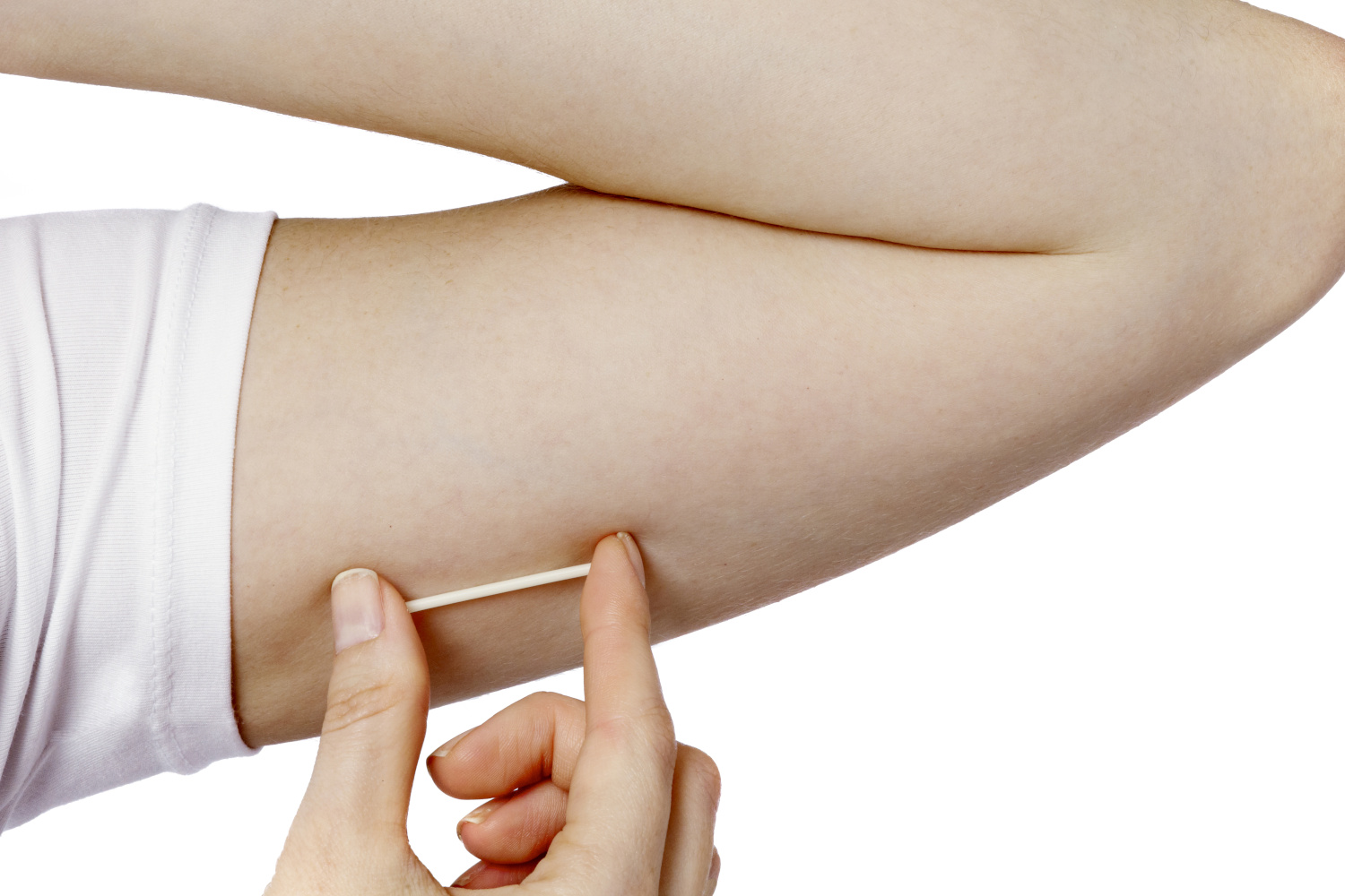 Implantes Hormonais - Dr. Pedro Zaiats